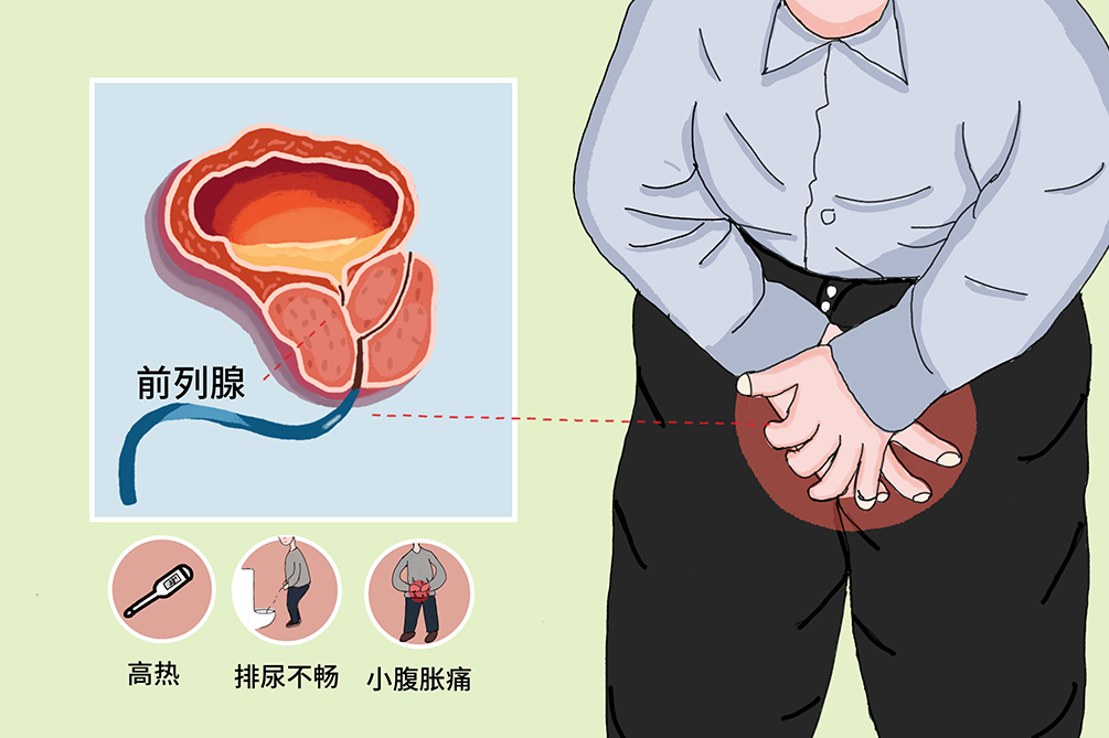 前列腺保健的一般做法，了解、預防與保護，前列腺保健指南，了解、預防與保護措施